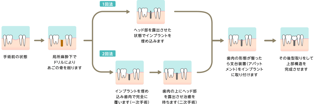 治療方法